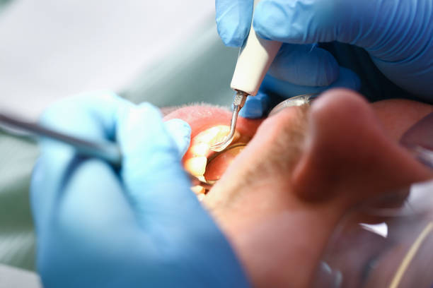 Best Weekend Emergency Dentist in Buena Vista, VA
