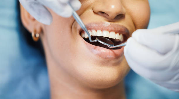 Best Emergency Dental Extractions in Buena Vista, VA